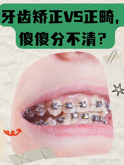 矫牙是什么