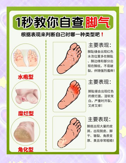 脚气看什么科室