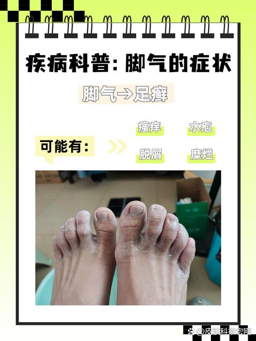 脚气看什么科室