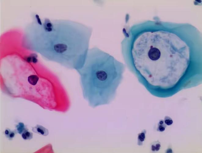 活化细胞是什么意思