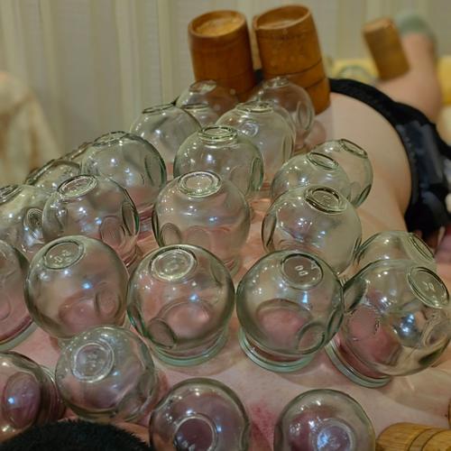 拔罐减肥抹的什么东西