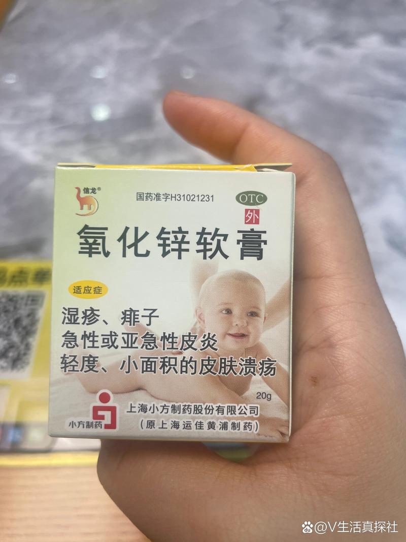 化妆品过敏用什么药
