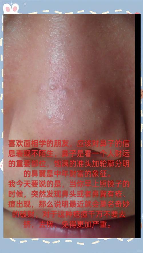 为什么鼻子老长痘