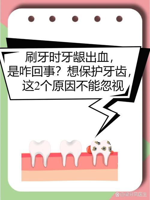 刷牙出血是什么病