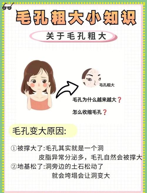 为什么毛孔越来越大