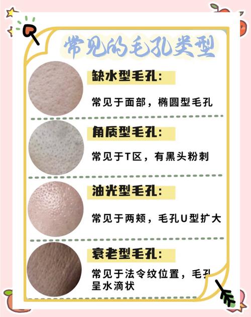 为什么毛孔越来越大