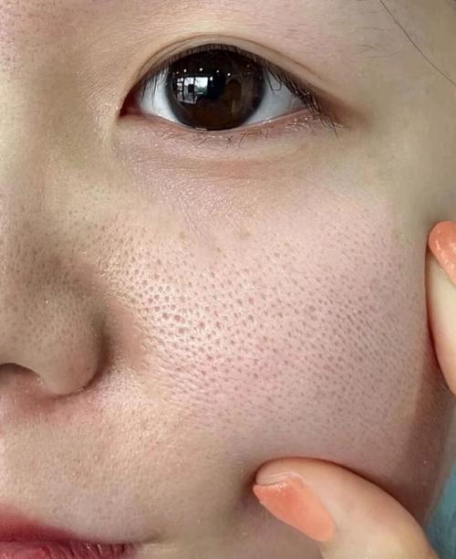 为什么毛孔越来越大