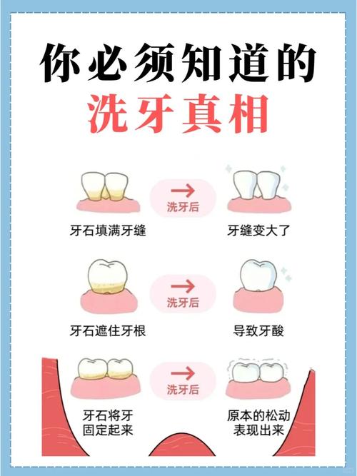 什么地方可以洗牙