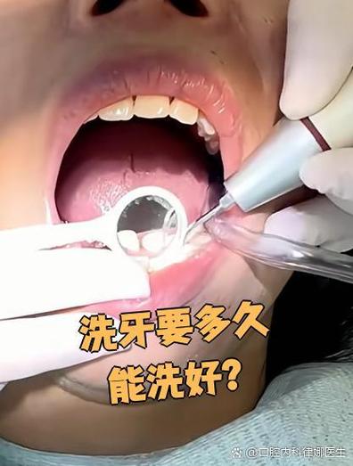 什么地方可以洗牙