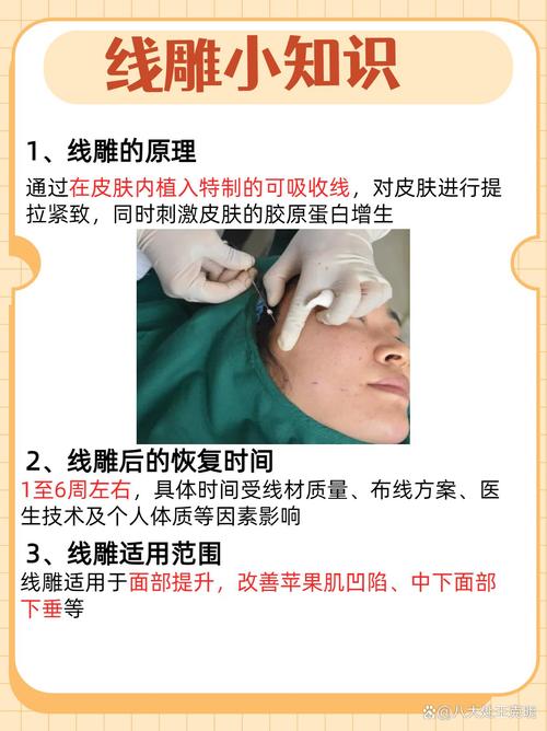 溶脂线雕减肥是什么医生