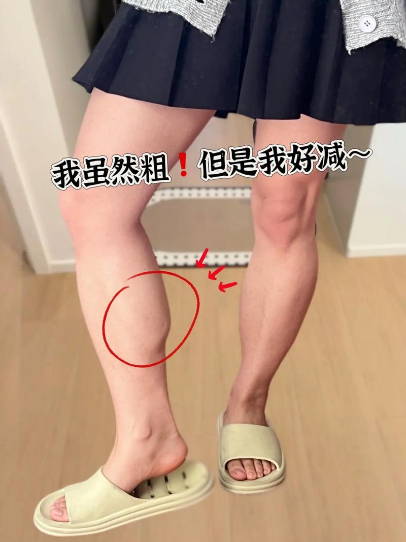小腿为什么越来越粗