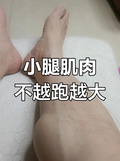 小腿为什么越来越粗