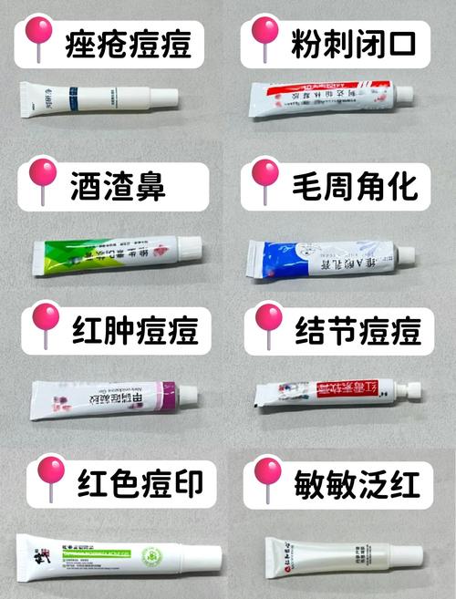 脸上长痘痘擦什么药