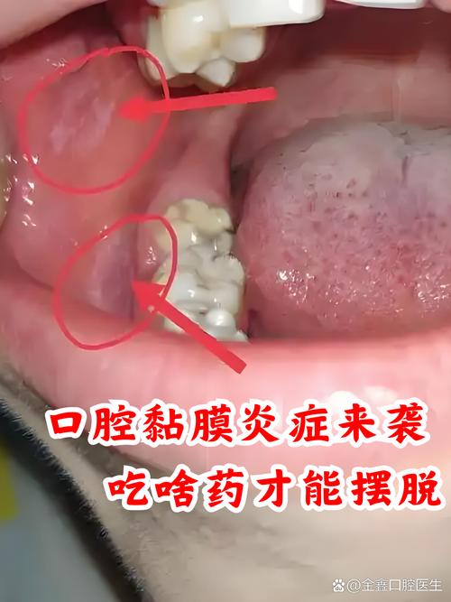 口腔黏膜看什么科