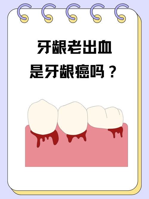 为什么牙齿老是出血