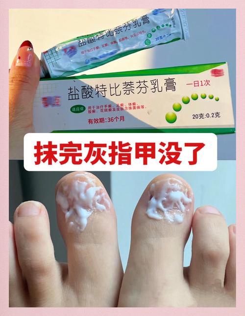 灰指甲挂什么号