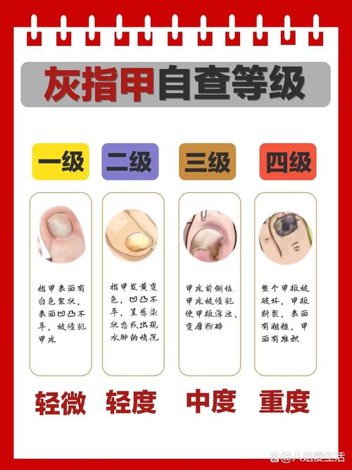 灰指甲挂什么号