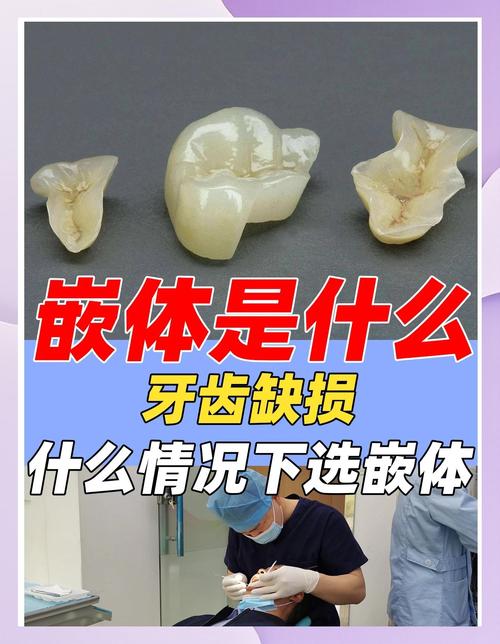 一般补牙用什么材料