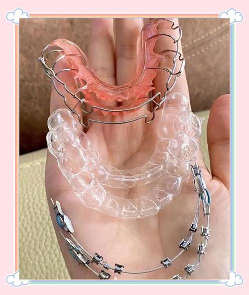 隐形牙套什么样子