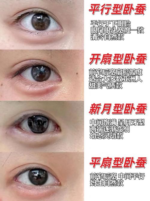 卧蚕是什么东西