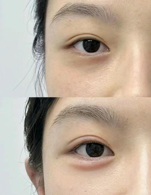 卧蚕是什么东西