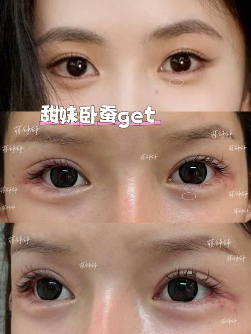 卧蚕是什么东西