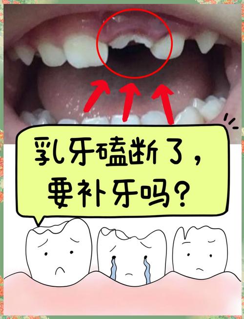 磕牙是什么原因