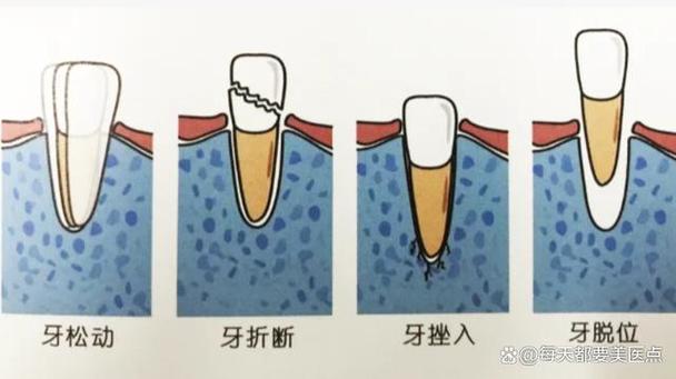 磕牙是什么原因