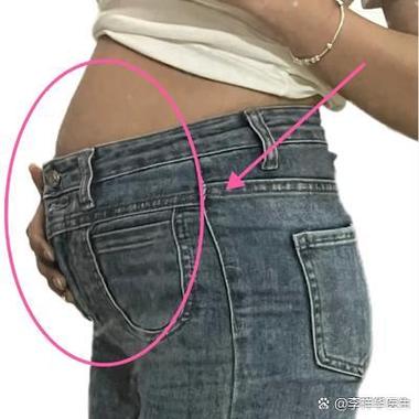 为什么减肥后面部凹