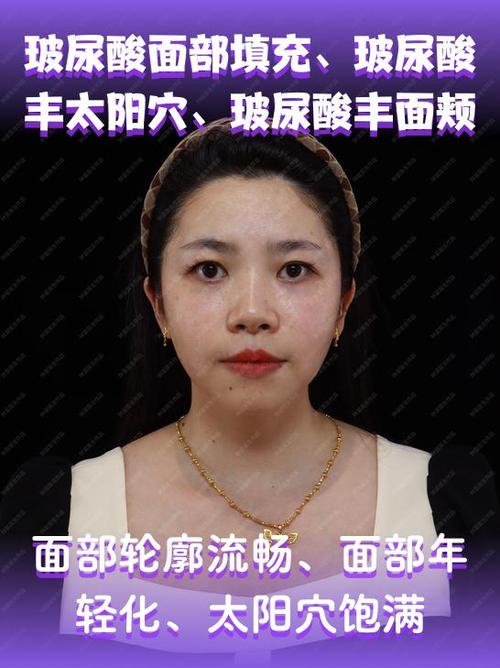 为什么减肥后面部凹