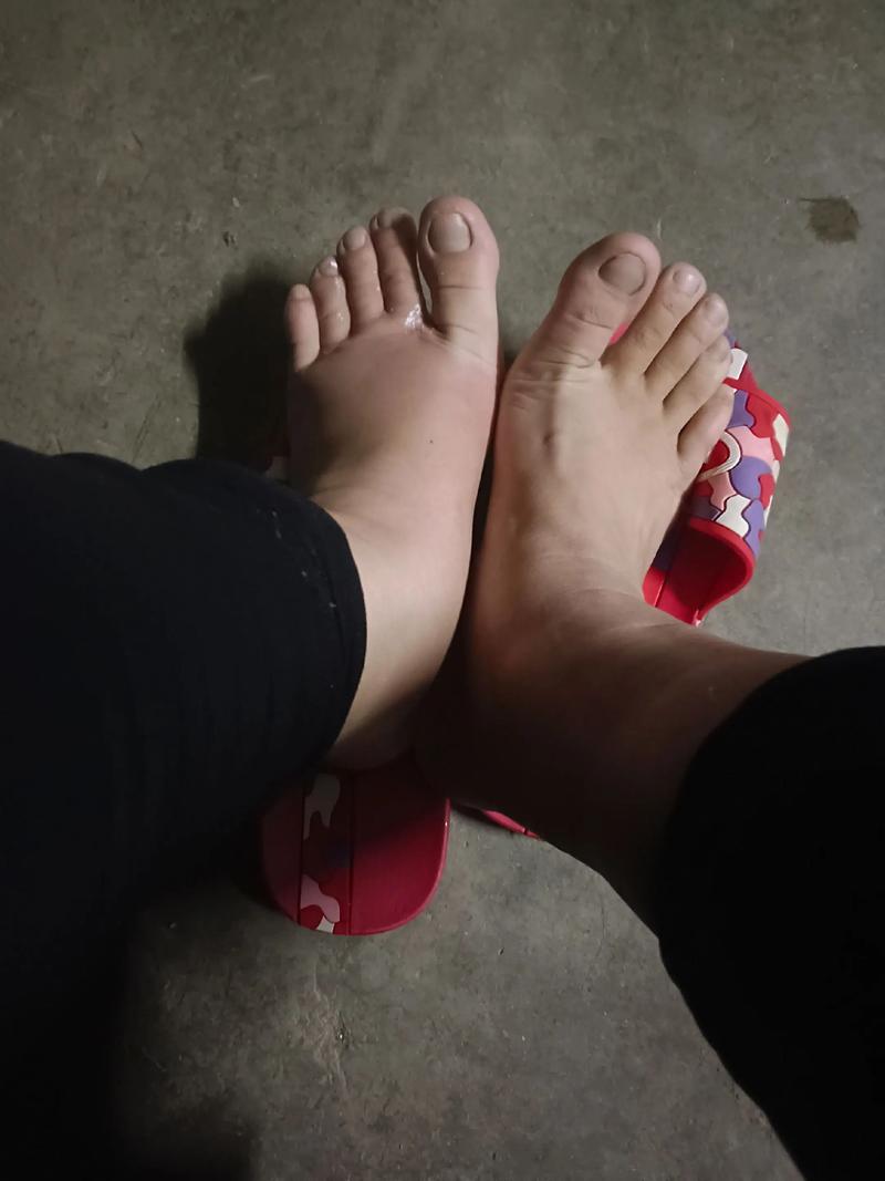 为什么减肥后脚会小