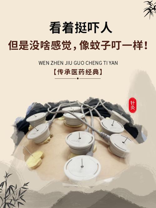 什么人针灸减肥无效果