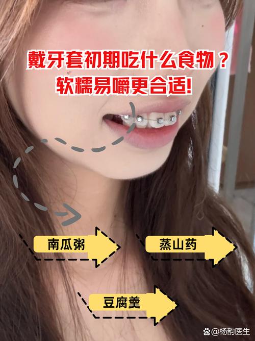 刚戴牙套能吃什么