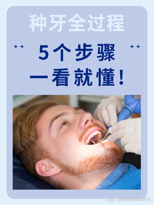 什么情况要种牙