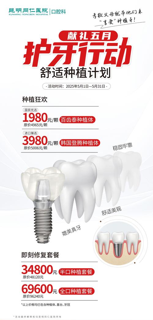 种植牙什么品牌好