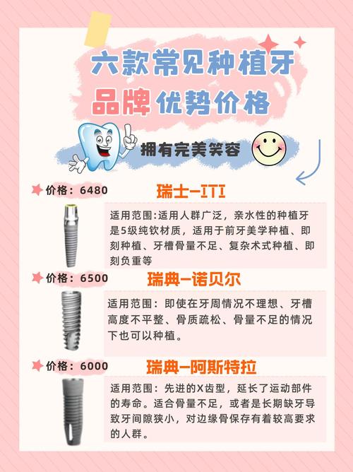 种植牙什么品牌好