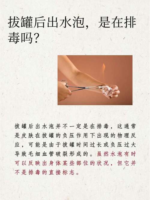 拔罐减肥的害处有什么