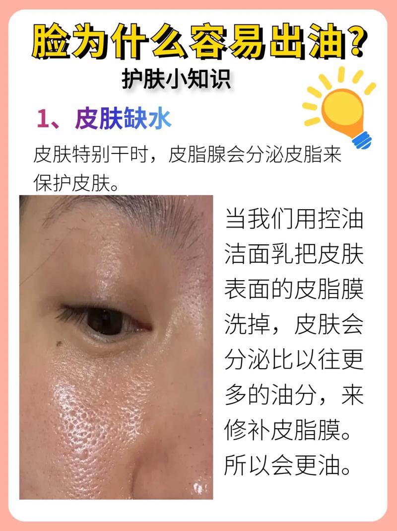 脸上为什么会有油