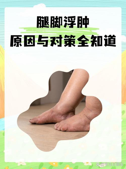 腿部肿胀是什么原因