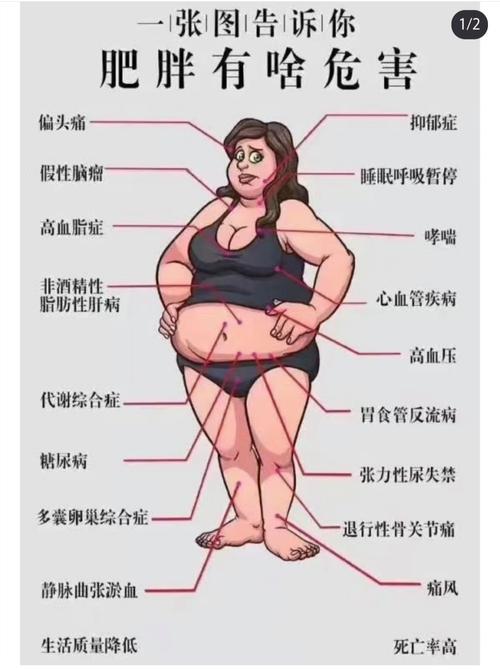胖是什么病