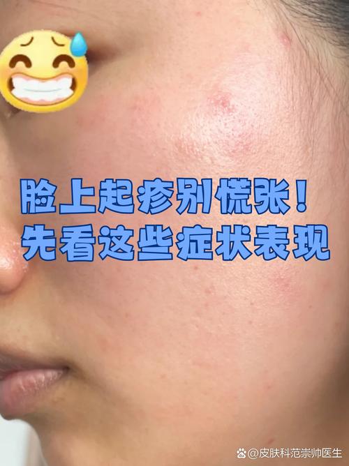 脸过敏是什么