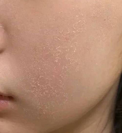 护肤品为什么会搓泥