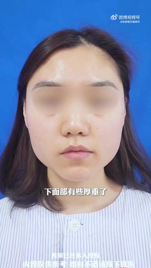 为什么脸会不对称