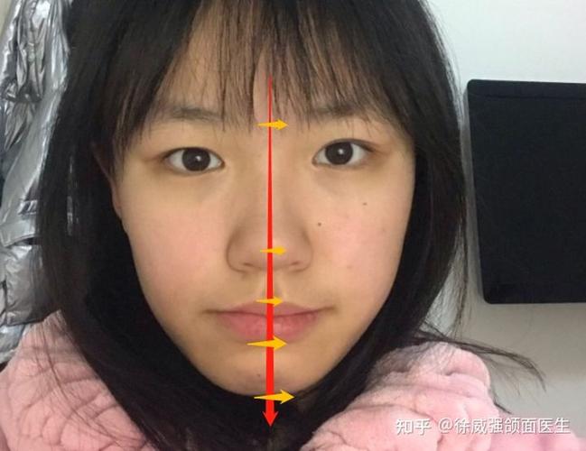 为什么脸会不对称
