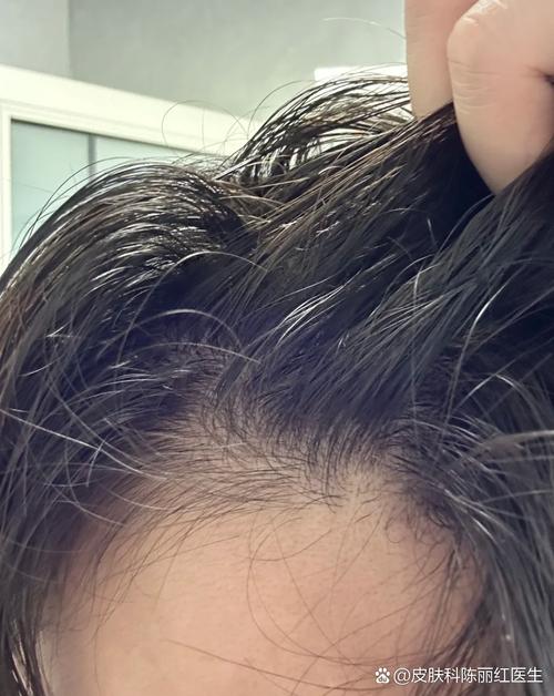 头发长的慢什么原因