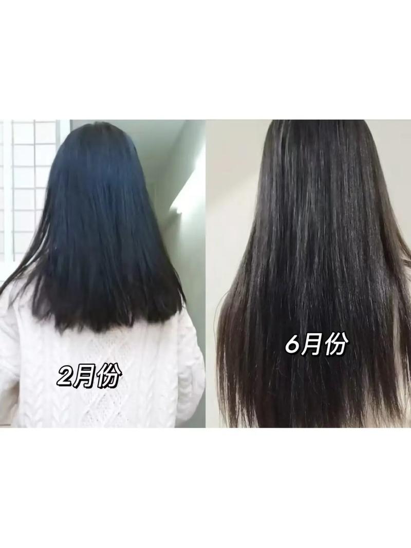 头发长的慢什么原因