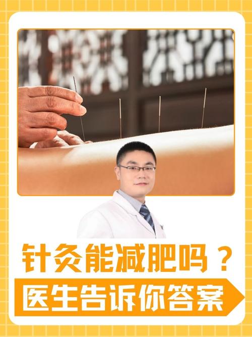 针灸减肥为什么会瘦