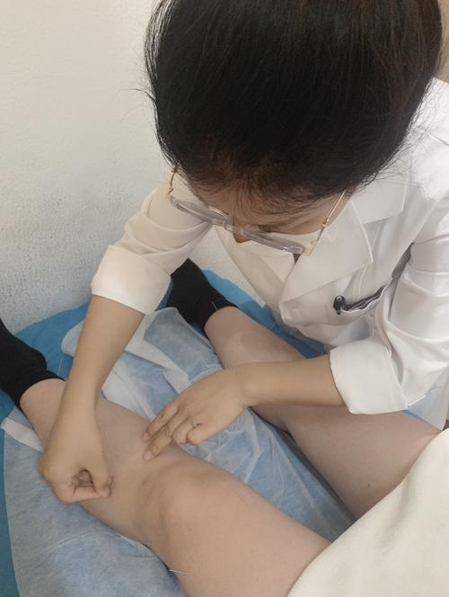 针灸减肥为什么会瘦