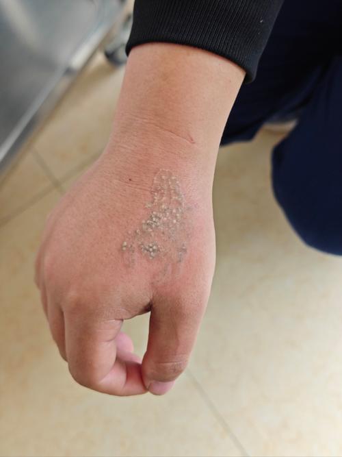 医院洗纹身挂什么科