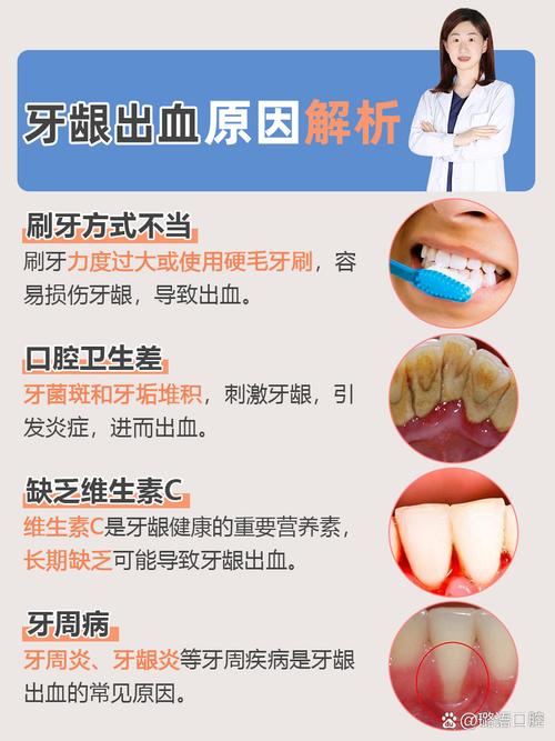 牙齿为什么老是出血